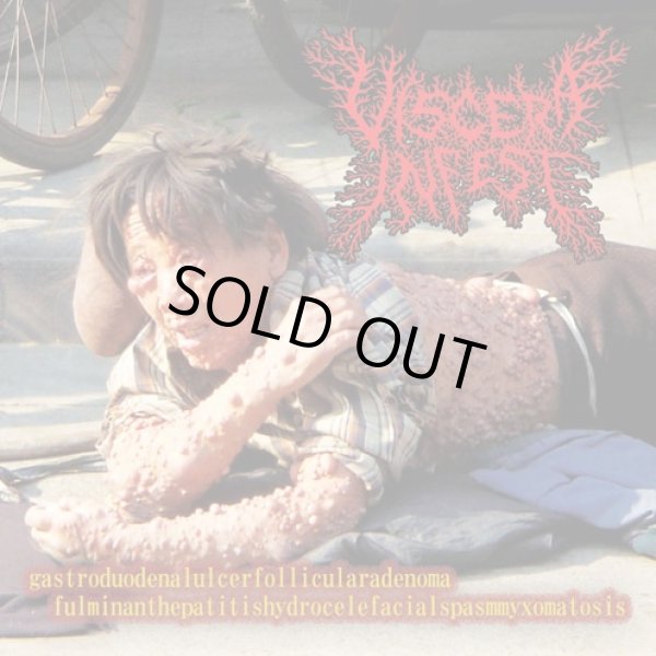 画像1: VISCERA INFEST, PARACOCCI DIOIDOMICO SISPROCTITISSARCO MUCOSIS / split (cd) Obliteration 